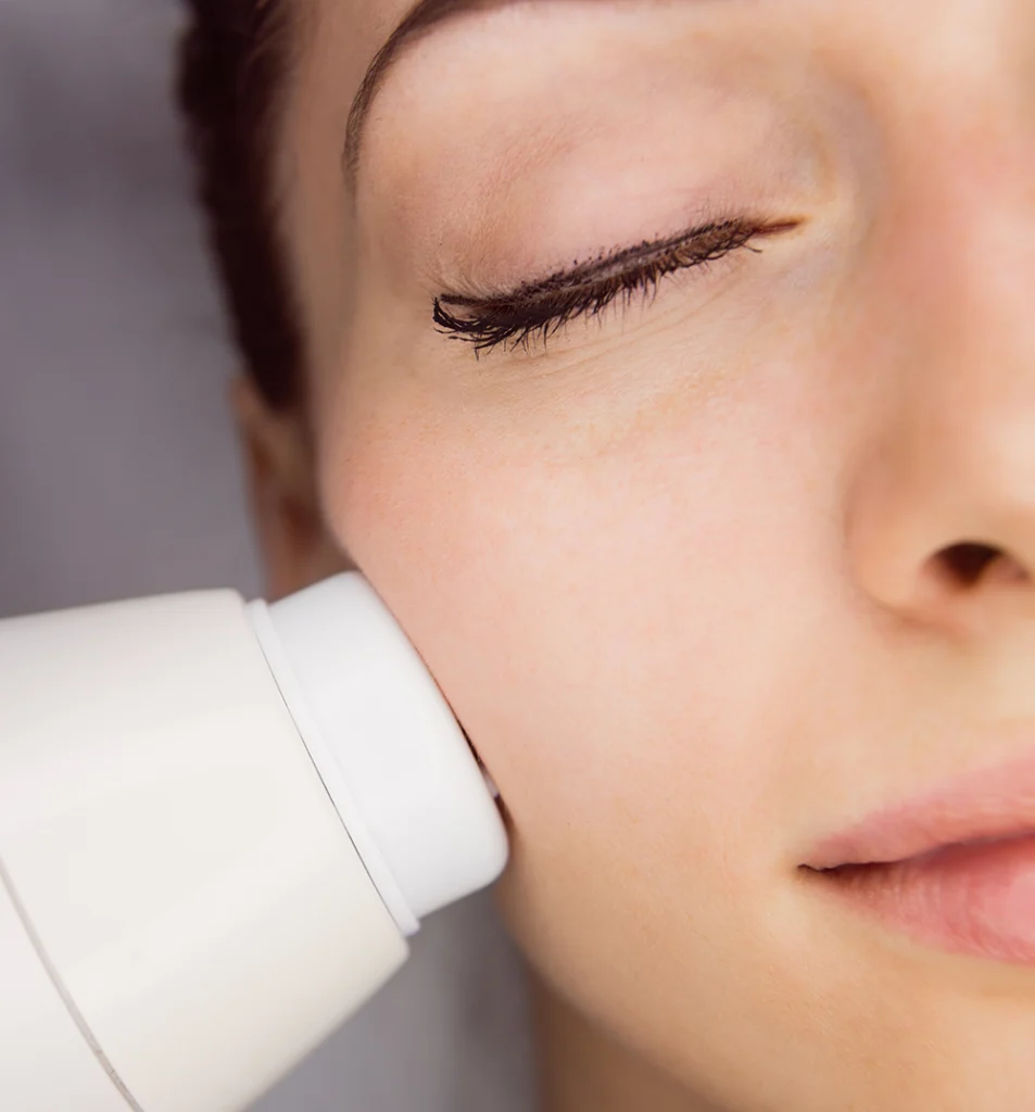 laser rejuvenecimiento e1758022055297