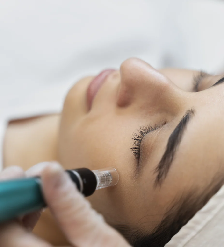 mesoterapia 1 e1758032856276